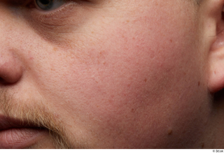 HD Face Skin Clifford Doyle cheek face skin pores skin…